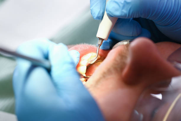 Best Same-Day Emergency Dental Services in Elmendorf, TX