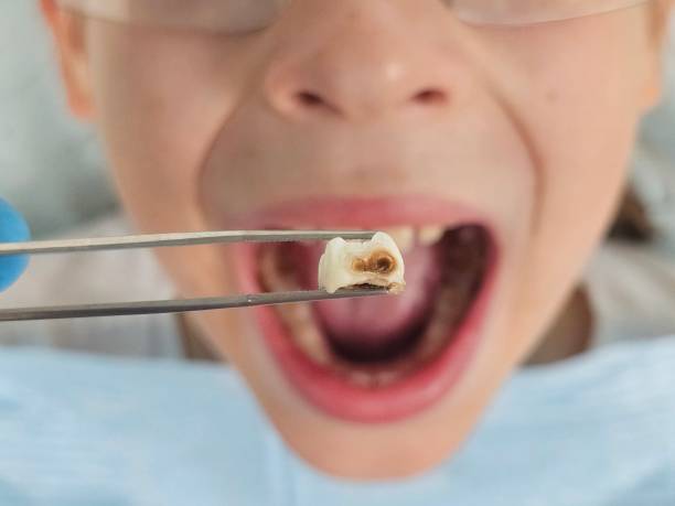 Best Pediatric Emergency Dentist in Elmendorf, TX