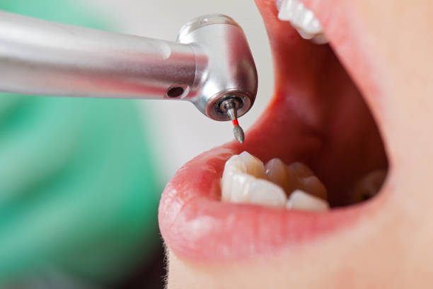 Best Emergency TMJ Treatment in Elmendorf, TX